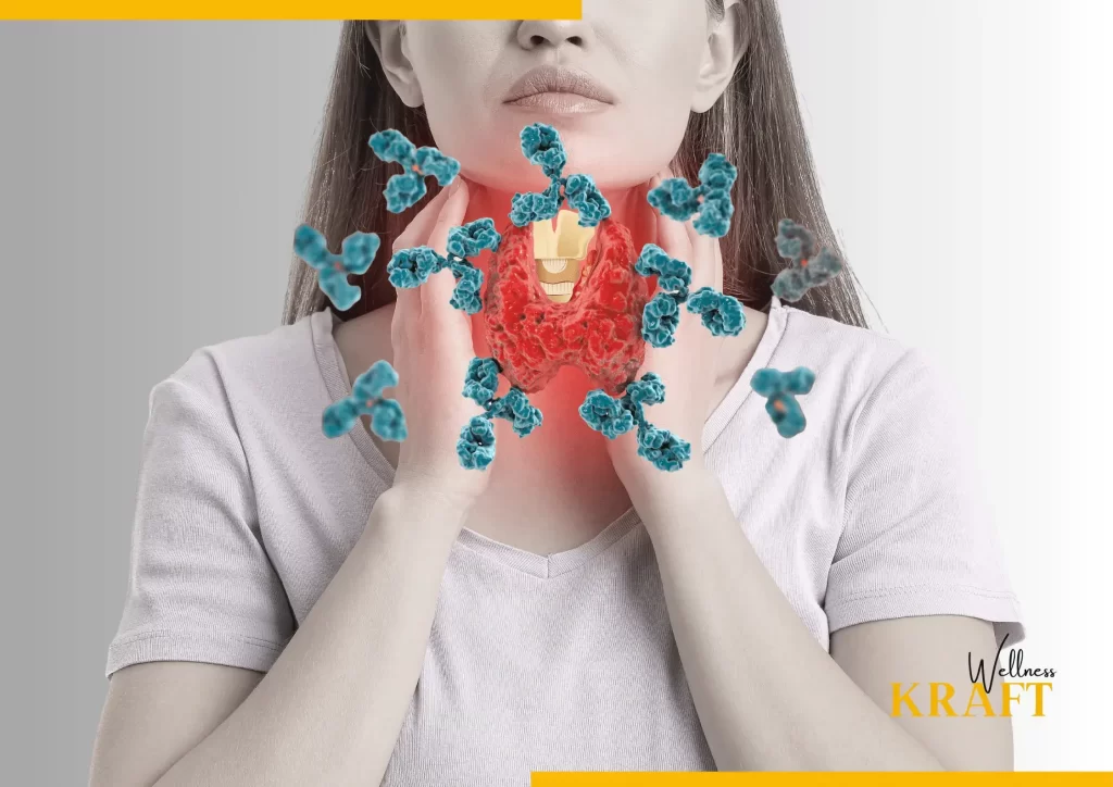 Thyroid Disorders 7 Causes and Natural Remedies