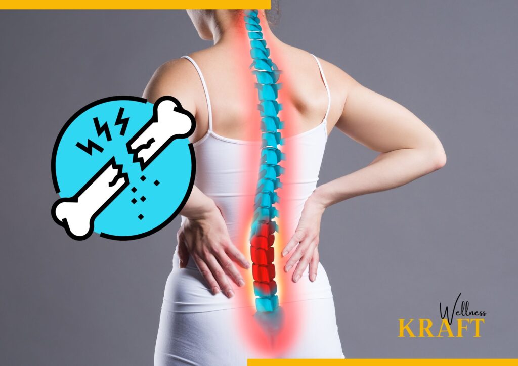 Combat Osteoporosis: 6 Essential Tips for Women